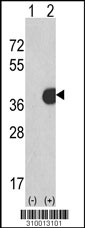 Western blot analysis of his-tag CDK2 (arrow) using his tag antibody. 293 cell lysates (2 ug/lane) either nontransfected (Lane 1) or transiently transfected with the CDK2 gene (Lane 2, Cat. #LY10013a).