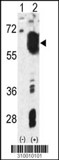 Western blot analysis of his-tag CAMK2A (arrow) using his tag antibody. 293 cell lysates (2 ug/lane) either nontransfected (Lane 1) or transiently transfected with the CAMK2A gene (Lane 2, Cat. #LY10010a).