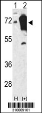 Western blot analysis of his-tag CAMKK1 (arrow) using his tag antibody. 293 cell lysates (2 ug/lane) either nontransfected (Lane 1) or transiently transfected with the CAMKK1 gene (Lane 2, Cat. #LY10009a).