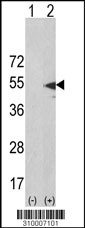 Western blot analysis of his-tag AK5 (arrow) using his tag antibody. 293 cell lysates (2 ug/lane) either nontransfected (Lane 1) or transiently transfected with the AK5 gene (Lane 2, Cat. #LY10007a).