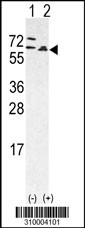 Western blot analysis of his-tag TNK2 (arrow) using his tag antibody. 293 cell lysates (2 ug/lane) either nontransfected (Lane 1) or transiently transfected with the TNK2 gene (Lane 2, Cat. #LY10004a).