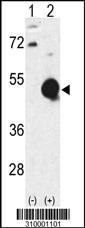 Western blot analysis of his-tag MVK (arrow) using his tag antibody. 293 cell lysates (2 ug/lane) either nontransfected (Lane 1) or transiently transfected with the MVK gene (Lane 2, Cat. #LY10001a).