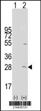 Western blot analysis of his-tag CCDC109B (arrow) using his tag antibody. 293 cell lysates (2 ug/lane) either nontransfected (Lane 1) or transiently transfected with the CCDC109B gene.