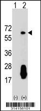 Western blot analysis of his-tag CCKBR (arrow) using his tag antibody. 293 cell lysates (2 ug/lane) either nontransfected (Lane 1) or transiently transfected with the CCKBR gene.