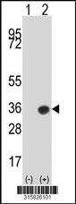 Western blot analysis of his-tag COQ9 (arrow) using his tag antibody. 293T cell lysates (2 ug/lane) either nontransfected (Lane 1) or transiently transfected with the COQ9 gene‘