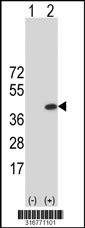 Western blot analysis of his-tag C15orf23 (arrow) using his tag antibody. 293T cell lysates (2 ug/lane) either nontransfected (Lane 1) or transiently transfected with the C15orf23 gene‘