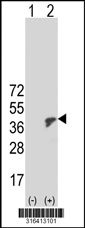 Western blot analysis of his-tag ANP32A (arrow) using his tag antibody. 293T cell lysates (2 ug/lane) either nontransfected (Lane 1) or transiently transfected with the ANP32A gene‘