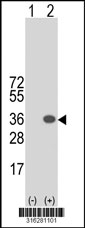 Western blot analysis of his-tag C13orf39 (arrow) using his tag antibody. 293T cell lysates (2 ug/lane) either nontransfected (Lane 1) or transiently transfected with the C13orf39 gene‘