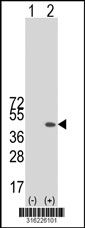 Western blot analysis of his-tag TICAM2 (arrow) using his tag antibody. 293T cell lysates (2 ug/lane) either nontransfected (Lane 1) or transiently transfected with the TICAM2 gene‘