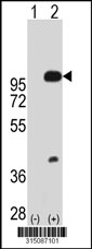 Western blot analysis of his-tag TCTN2 (arrow) using his tag antibody. 293T cell lysates (2 ug/lane) either nontransfected (Lane 1) or transiently transfected with the TCTN2 gene‘