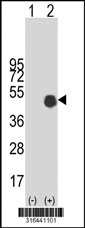 Western blot analysis of his-tag RASSF7 (arrow) using his tag antibody. 293T cell lysates (2 ug/lane) either nontransfected (Lane 1) or transiently transfected with the RASSF7 gene‘