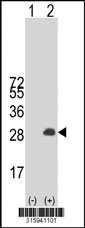 Western blot analysis of his-tag REEP3 (arrow) using his tag antibody. 293T cell lysates (2 ug/lane) either nontransfected (Lane 1) or transiently transfected with the REEP3 gene‘
