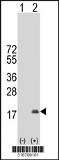 Western blot analysis of his-tag PROK2 (arrow) using his tag antibody. 293T cell lysates (2 ug/lane) either nontransfected (Lane 1) or transiently transfected with the PROK2 gene‘