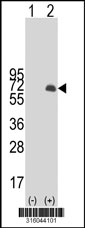 Western blot analysis of his-tag GALNAC4S-6ST (arrow) using his tag antibody. 293T cell lysates (2 ug/lane) either nontransfected (Lane 1) or transiently transfected with the GALNAC4S-6ST gene‘