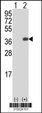 Western blot analysis of his-tag CCDC59 (arrow) using his tag antibody. 293T cell lysates (2 ug/lane) either nontransfected (Lane 1) or transiently transfected with the CCDC59 gene‘