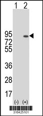Western blot analysis of his-tag RRN3 (arrow) using his tag antibody. 293T cell lysates (2 ug/lane) either nontransfected (Lane 1) or transiently transfected with the RRN3 gene‘