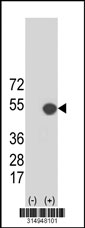 Western blot analysis of his-tag CXCR6 (arrow) using his tag antibody. 293T cell lysates (2 ug/lane) either nontransfected (Lane 1) or transiently transfected with the CXCR6 gene‘