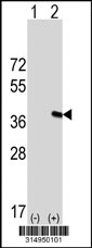 Western blot analysis of his-tag GALM (arrow) using his tag antibody. 293T cell lysates (2 ug/lane) either nontransfected (Lane 1) or transiently transfected with the GALM gene‘
