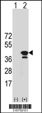 Western blot analysis of his-tag SLAMF8 (arrow) using his tag antibody. 293T cell lysates (2 ug/lane) either nontransfected (Lane 1) or transiently transfected with the SLAMF8 gene‘