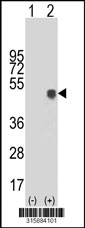Western blot analysis of his-tag KLF3 (arrow) using his tag antibody. 293T cell lysates (2 ug/lane) either nontransfected (Lane 1) or transiently transfected with the KLF3 gene‘
