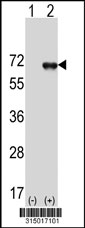 Western blot analysis of his-tag BAG3 (arrow) using his tag antibody. 293T cell lysates (2 ug/lane) either nontransfected (Lane 1) or transiently transfected with the BAG3 gene‘