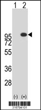 Western blot analysis of his-tag DAXX (arrow) using his tag antibody. 293T cell lysates (2 ug/lane) either nontransfected (Lane 1) or transiently transfected with the DAXX gene‘