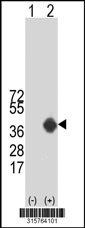 Western blot analysis of his-tag USF1 (arrow) using his tag antibody. 293T cell lysates (2 ug/lane) either nontransfected (Lane 1) or transiently transfected with the USF1 gene‘