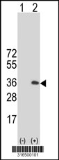 Western blot analysis of his-tag ADAMTSL5 (arrow) using his tag antibody. 293T cell lysates (2 ug/lane) either nontransfected (Lane 1) or transiently transfected with the ADAMTSL5 gene‘