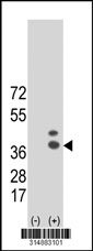 Western blot analysis of his-tag BDH1 (arrow) using his tag antibody. 293T cell lysates (2 ug/lane) either nontransfected (Lane 1) or transiently transfected with the BDH1 gene‘