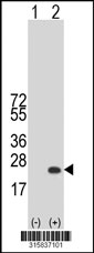 Western blot analysis of his-tag AGR3 (arrow) using his tag antibody. 293T cell lysates (2 ug/lane) either nontransfected (Lane 1) or transiently transfected with the AGR3 gene‘