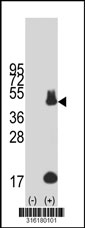 Western blot analysis of his-tag PDCD1LG2 (arrow) using his tag antibody. 293T cell lysates (2 ug/lane) either nontransfected (Lane 1) or transiently transfected with the PDCD1LG2 gene‘