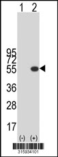 Western blot analysis of his-tag B3GNT3 (arrow) using his tag antibody. 293T cell lysates (2 ug/lane) either nontransfected (Lane 1) or transiently transfected with the B3GNT3 gene‘