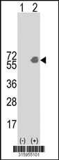 Western blot analysis of his-tag PSG1 (arrow) using his tag antibody. 293T cell lysates (2 ug/lane) either nontransfected (Lane 1) or transiently transfected with the PSG1 gene‘