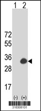 Western blot analysis of his-tag OLAH (arrow) using his tag antibody. 293T cell lysates (2 ug/lane) either nontransfected (Lane 1) or transiently transfected with the OLAH gene‘