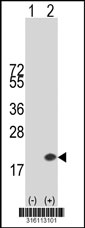 Western blot analysis of his-tag ATP6V1F (arrow) using his tag antibody. 293T cell lysates (2 ug/lane) either nontransfected (Lane 1) or transiently transfected with the ATP6V1F gene‘