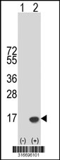 Western blot analysis of his-tag ATP6V0E1 (arrow) using his tag antibody. 293T cell lysates (2 ug/lane) either nontransfected (Lane 1) or transiently transfected with the ATP6V0E1 gene‘