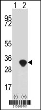 Western blot analysis of his-tag ATPAF2 (arrow) using his tag antibody. 293T cell lysates (2 ug/lane) either nontransfected (Lane 1) or transiently transfected with the ATPAF2 gene‘