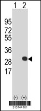 Western blot analysis of his-tag RHOJ (arrow) using his tag antibody. 293T cell lysates (2 ug/lane) either nontransfected (Lane 1) or transiently transfected with the RHOJ gene‘