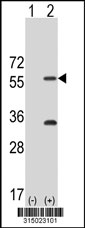Western blot analysis of his-tag ADAD2 (arrow) using his tag antibody. 293T cell lysates (2 ug/lane) either nontransfected (Lane 1) or transiently transfected with the ADAD2 gene‘