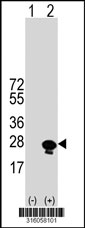 Western blot analysis of his-tag RHOD (arrow) using his tag antibody. 293T cell lysates (2 ug/lane) either nontransfected (Lane 1) or transiently transfected with the RHOD gene‘