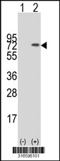 Western blot analysis of his-tag MED26 (arrow) using his tag antibody. 293T cell lysates (2 ug/lane) either nontransfected (Lane 1) or transiently transfected with the MED26 gene‘