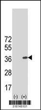 Western blot analysis of his-tag MED6 (arrow) using his tag antibody. 293T cell lysates (2 ug/lane) either nontransfected (Lane 1) or transiently transfected with the MED6 gene‘