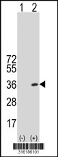 Western blot analysis of his-tag RFXANK (arrow) using his tag antibody. 293T cell lysates (2 ug/lane) either nontransfected (Lane 1) or transiently transfected with the RFXANK gene‘
