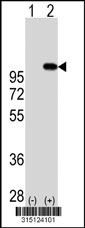 Western blot analysis of his-tag AMPH (arrow) using his tag antibody. 293T cell lysates (2 ug/lane) either nontransfected (Lane 1) or transiently transfected with the AMPH gene‘