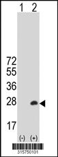 Western blot analysis of his-tag ASRGL1 (arrow) using his tag antibody. 293T cell lysates (2 ug/lane) either nontransfected (Lane 1) or transiently transfected with the ASRGL1 gene‘