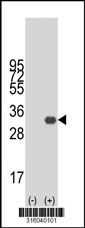 Western blot analysis of his-tag MIOX (arrow) using his tag antibody. 293T cell lysates (2 ug/lane) either nontransfected (Lane 1) or transiently transfected with the MIOX gene‘