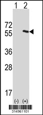 Western blot analysis of his-tag AIPL1 (arrow) using his tag antibody. 293T cell lysates (2 ug/lane) either nontransfected (Lane 1) or transiently transfected with the AIPL1 gene‘