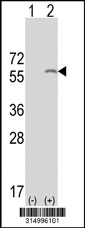 Western blot analysis of his-tag PARP3 (arrow) using his tag antibody. 293T cell lysates (2 ug/lane) either nontransfected (Lane 1) or transiently transfected with the PARP3 gene‘