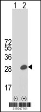 Western blot analysis of his-tag ALKBH2 (arrow) using his tag antibody. 293T cell lysates (2 ug/lane) either nontransfected (Lane 1) or transiently transfected with the ALKBH2 gene‘