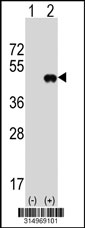 Western blot analysis of his-tag ALKBH1 (arrow) using his tag antibody. 293T cell lysates (2 ug/lane) either nontransfected (Lane 1) or transiently transfected with the ALKBH1 gene‘